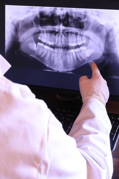 Best Emergency Dental Care for Broken or Chipped Teeth in Fulda, MN