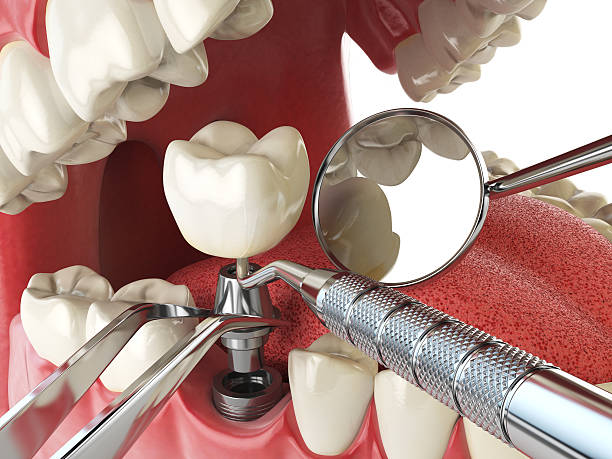 Best Emergency Treatment for Dental Infections or Abscesses in Fulda, MN